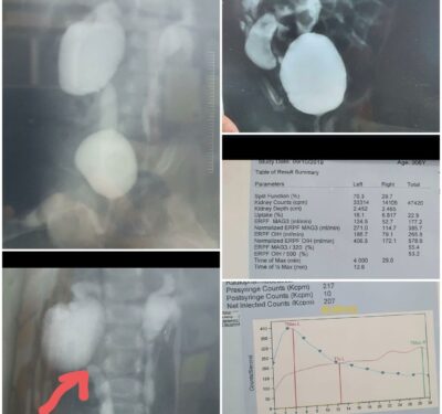 Xray