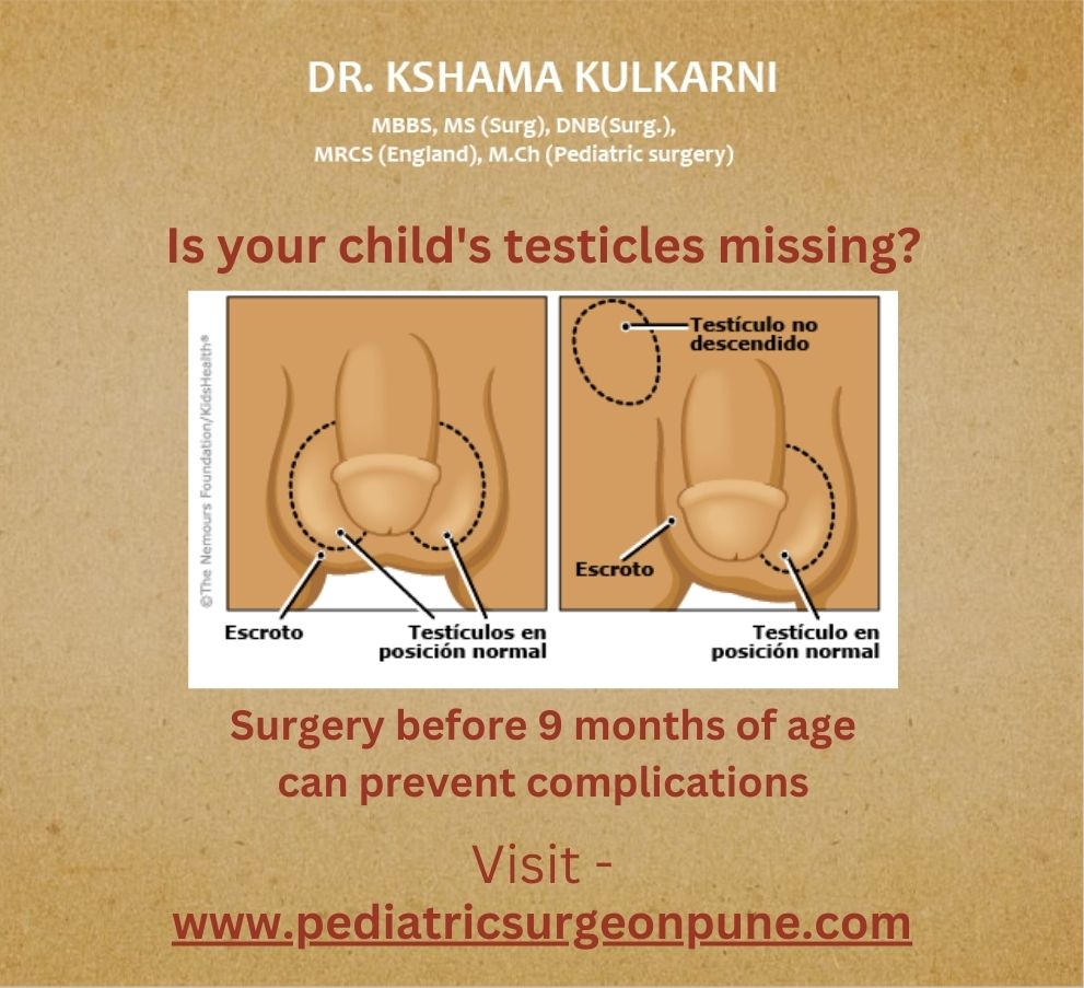 Undescended Testis